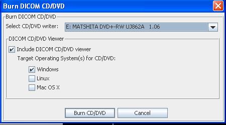 User Guide - Technologist Supplement The Burn DICOM CD/DVD dialog window will be displayed.
