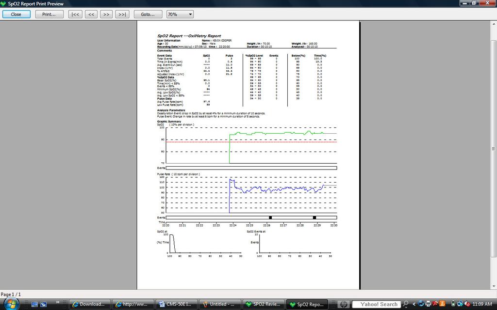 print from Summary Report, Full Study Report, Oximetry