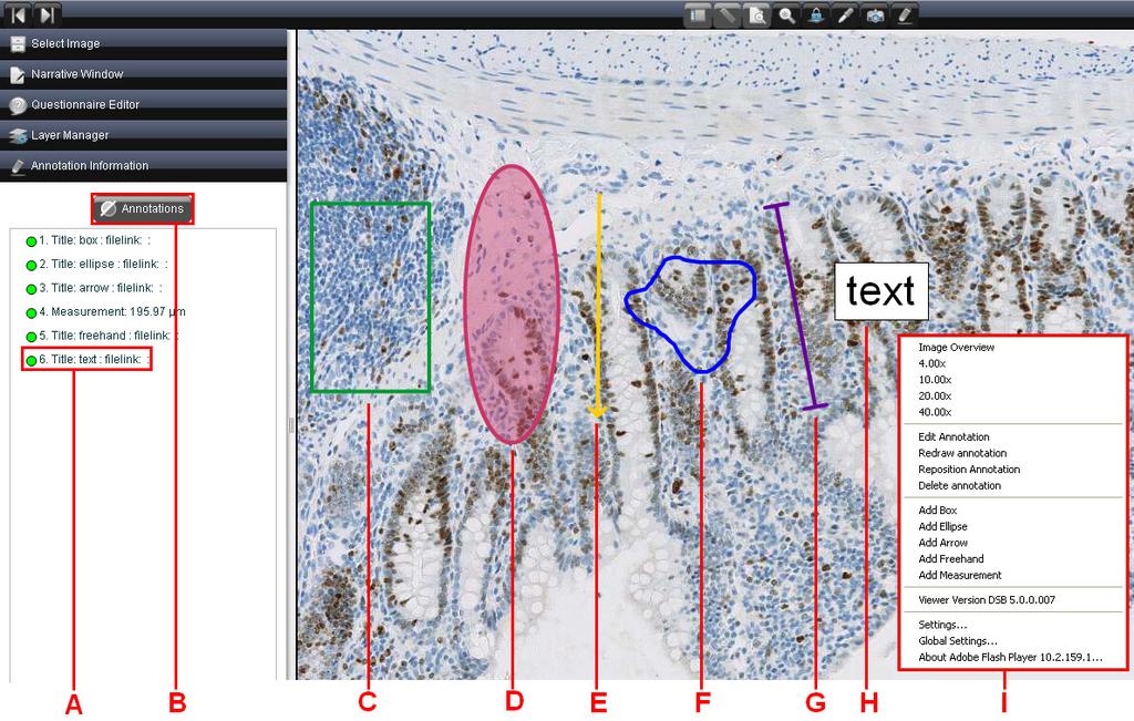 6.3 Annotations Annotations are visible areas of interest superimposed on the image that can be created without changing the underlying image. A. Select annotation name to zoom to that annotation, show details and hide all other annotations B.
