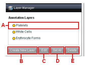 6.4 Layer Manager Digital SlideBox 5.0 Use the layer manager to create groups of annotations.