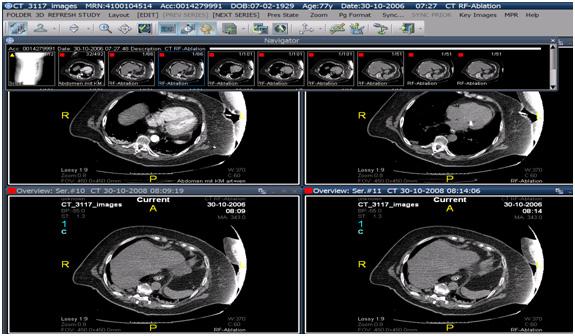 Sample case study Figure 11 shows typical images viewed by healthcare professionals in