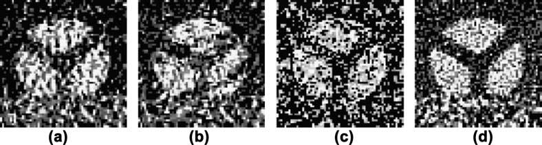 The watermarked Lena image shown in Fig. 5(a) is 64 times compressed. At 64 times compression the image in Fig. 5(a) is showing blocking artifacts, but extracted logo shown in Fig.