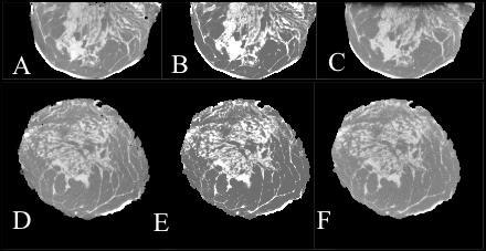 Sagital Coronal Breast CT Simulation SPECIMEN PHANTOM SIMULATION Research Power Law