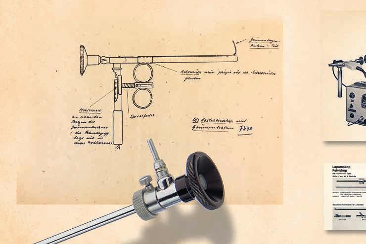 Evolution 1953 1956 1959 1960 Karl Storz develops and produces his first endoscope. The first extracorporeal electron flash device allows endoscopic photography in unprecedented quality.