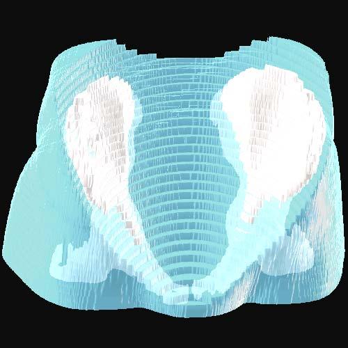 girdle using the LLS model and active contours: