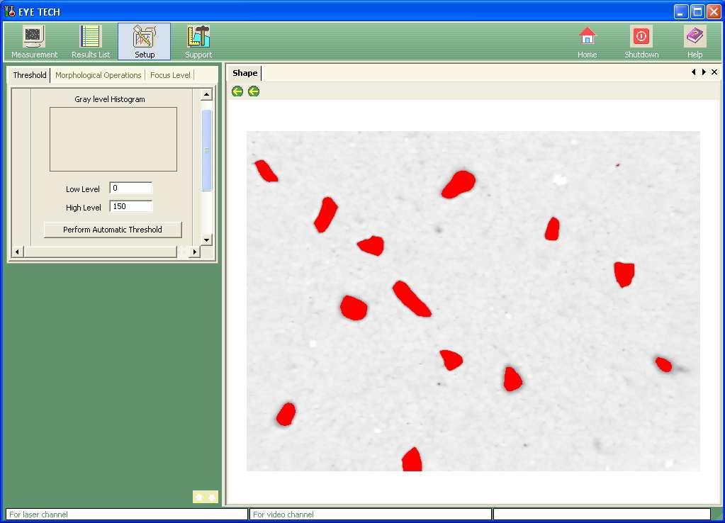 EyeTech software includes many IA procedures such as: Pre-processing procedures Image Filters Region of