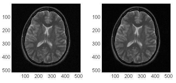 (a) (b) Figure 5.13: (a) Brain image reconstructed from 100% of k-space.