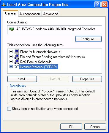 In the Local Area Connection Status window, click Properties. 4.