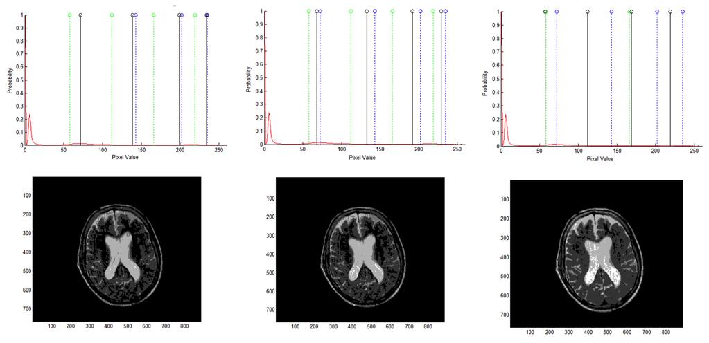 (a) brain MRI image, (b) histogram of the image in (a), (c) Obtained Pareto fronts using MOPSO for a 7, 5 and 3 classes,