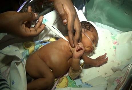 Newborn Mortality Is a Solvable Problem U.N. Sustainable Development Goal, target 3.