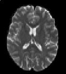Magnetic resonance imaging can