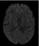 MRI g 4 g 5 Diffusion encoding
