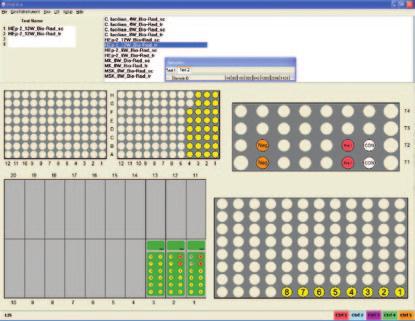 IFA Software Printed Worksheet to record pattern interpretations Integrated slide