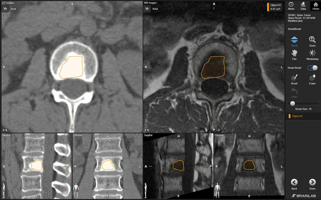 Layouts for Spine SRS Procedures Spine View ① ② ③ Figure 9 The Spine view displays two image sets.