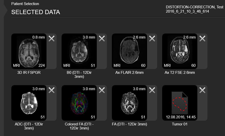 Multi-Modal Options Example Containing Multi-Modal Image Sets Figure 26 Option Outline the tumor in an MR-T1 set Switch view to a fused MR-T2 set and continue outlining Information Data Used for