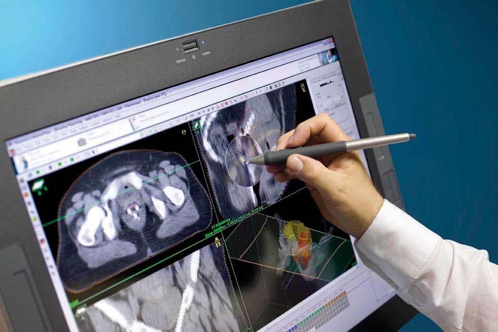 Anatomy-based treatment planning for HDR/PDR brachytherapy In its rich history, Nucletron has developed a wide range of treatment planning solutions.