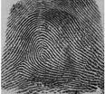 such as skin diseases and removed from the finger and pattern. side effect of cancer drug grafted back in different can also obliterate positions. fingerprints. II.
