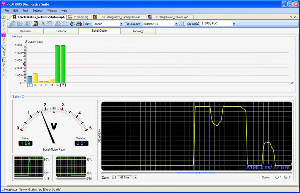 3. PB-DIAG-SUITE: Signal Quality Window: Oscilloscope Localize the problem with the Oscilloscope: Select device by a click to show the signal of this node Place cursor 1 to rising edge