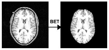 FAST: Input First use BET to remove non-brain All volumetric results are highly sensitive to errors here.