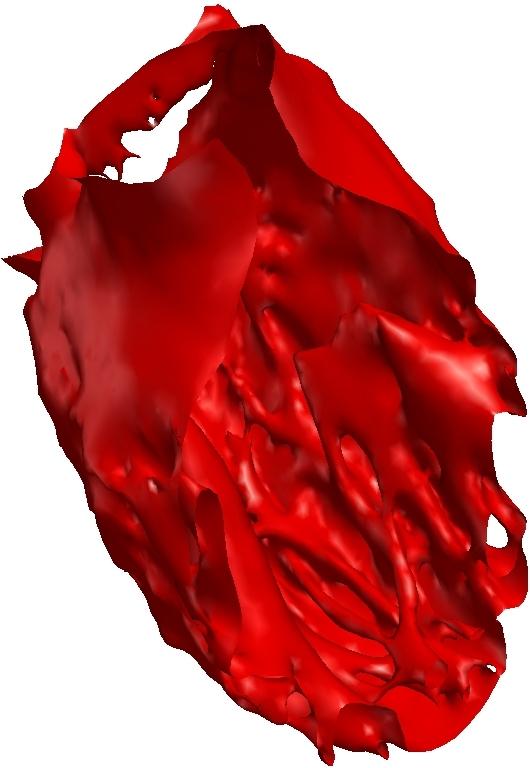 3 Results and Validation We applied our reconstruction framework to 10 cardiac CT volumes, which captures a whole cycle of cardiac contraction.