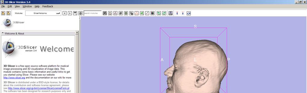 Loading a 3D Scene Slicer displays a 3D model of the head in the 3DViewer, and