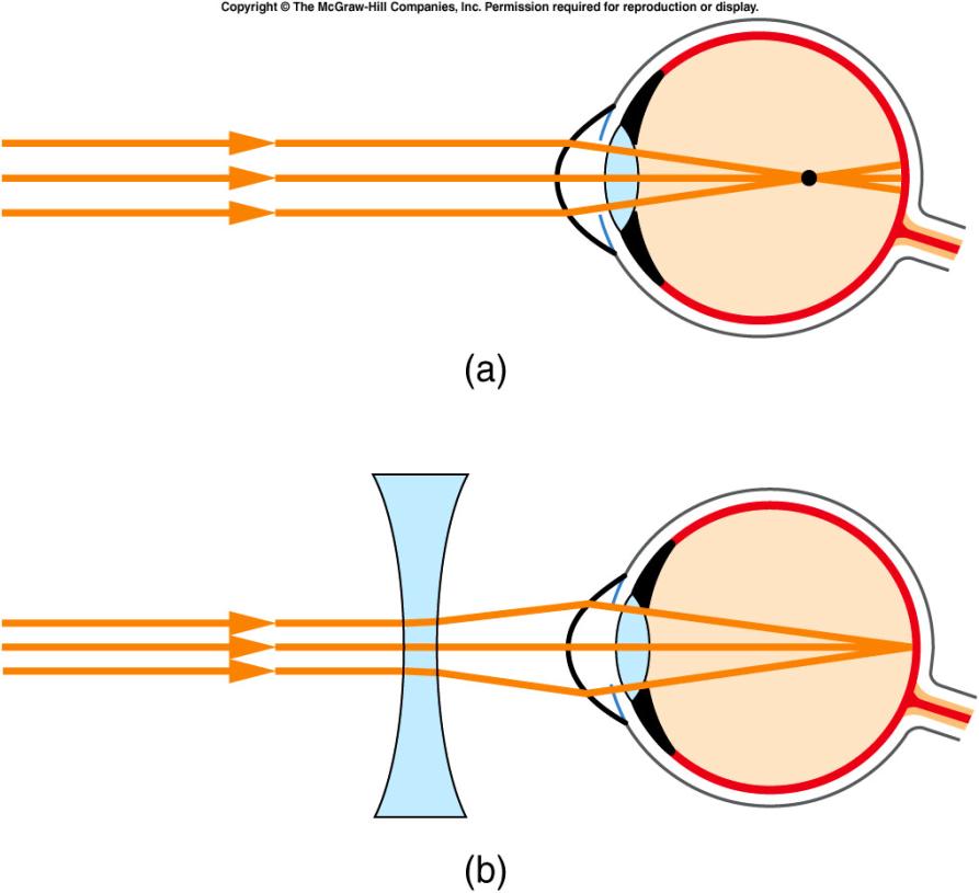 Eye Sight The eye contains two positive lenses (cornea)