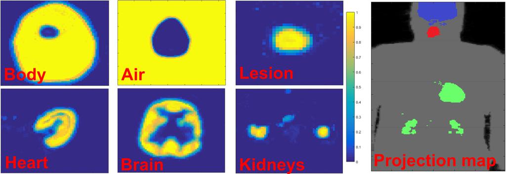 Tumor Lesion Segmentation from 3D PET 5 Fig. 1: Example of class probabilities. Images on the left: Probability maps over different classes in the transverse plane (different scales used for clarity).