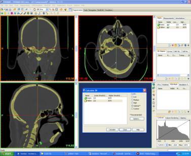 STL+ Module STL+ module provides interface options via triangulated formats. Figure 3.5.2: The Dicom Images are imported into the Software 3.