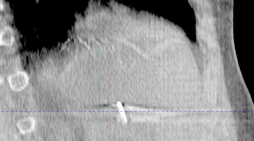 CBCT CT Example 2: