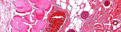 75 1 mm Arterial microsphere
