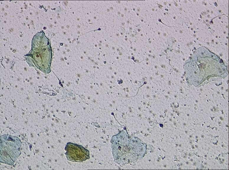 Rapid Separation of Spermatozoa and Epithelial