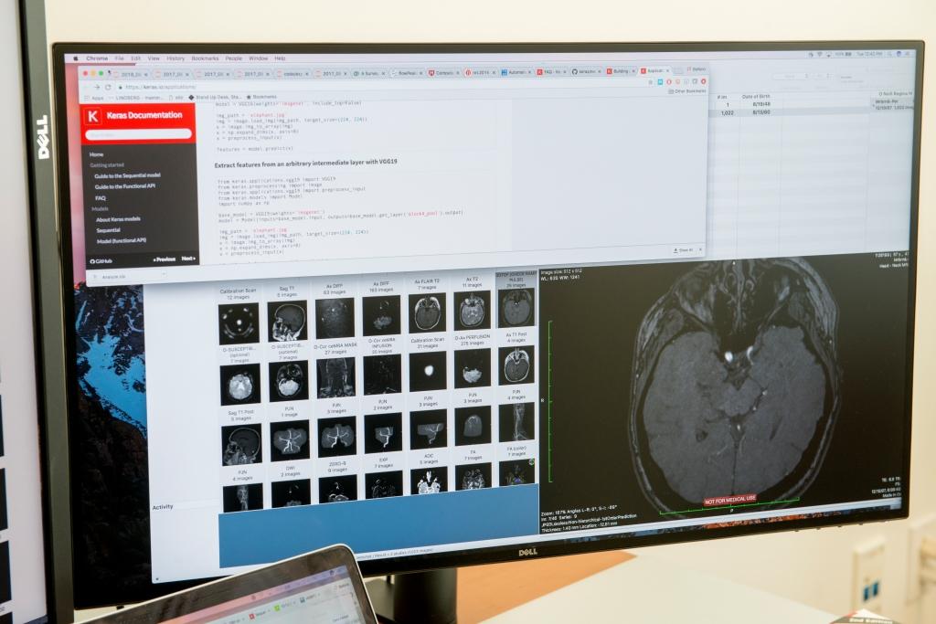 SMARTER SYSTEMS FOR AI ASSISTED RADIOLOGY Center for Clinical Data Science Received First DGX Systems with