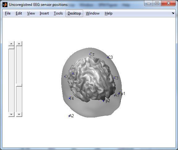 window Figure 13 : EEG