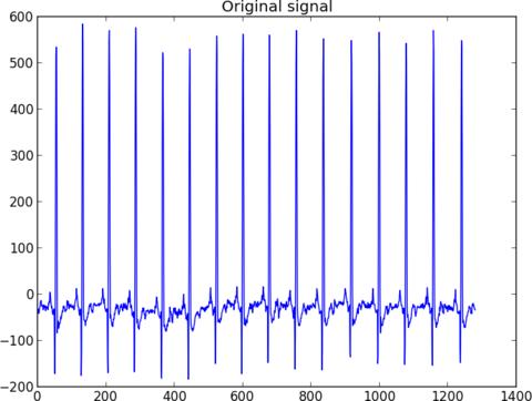Now we have the data in a numpy array ecg. matplotlib.pyplot. We can quickly plot what the data looks like using Fig. 1.1: Original ECG signal as plotted by matplotlib.pyplot. from matplotlib.