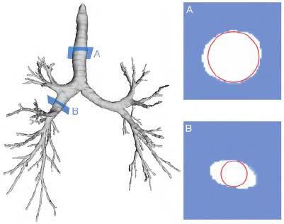 Characterization Primary goal: correct representation of cross-sectional shape Simplifying model-assumption of circular cross-sections is invalid for pathologic vessel parts, e.g., aneurysms, and also for certain non-pathologic vessels, e.