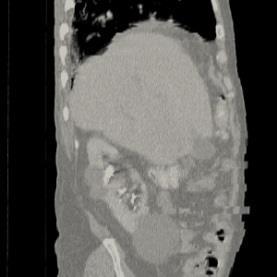 Scanning proton gantry 22 possible tracking workflow liver MRI motion information