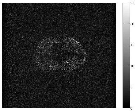 5. Fig. 5a shows a single direction image reconstructed from full k-space data using IFT. Fig. 5b shows the corresponding image reconstructed from sparse data using the current method.