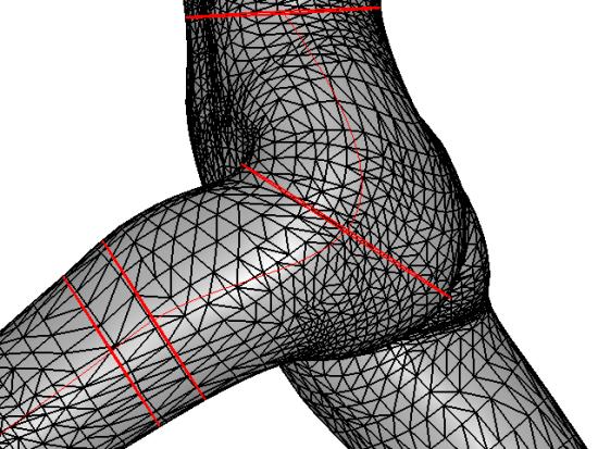 4.2 Editing a sweep-based deformation At extreme joint angles, a sweep-based deformation may not appear quite as natural as a real human body in the same pose because the sweep-based deformation does
