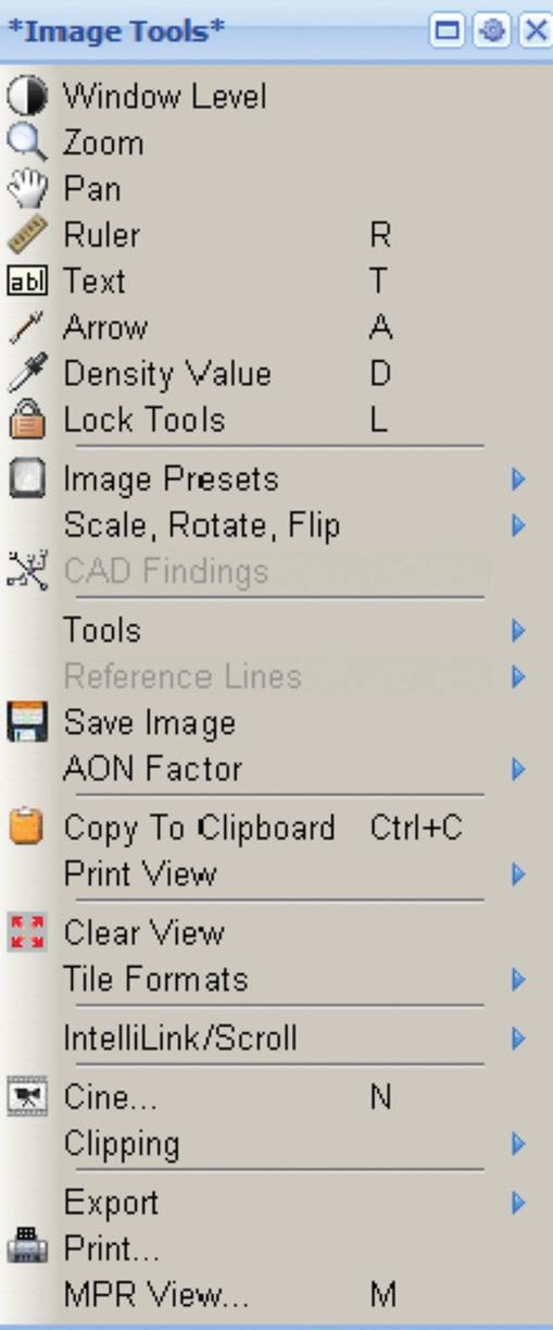 10 synapse quick guide Right Click Menu Options Modality Presets Access to Additional Tools Menu Intelli- Navigation Options Shortcut to Window/Level Zoom Pan Left click and hold over the