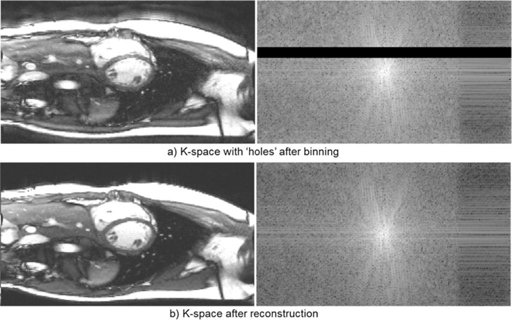 Xue et al. Journal of Cardiovascular Magnetic Resonance 2013, 15:102 Page 8 of 15 Figure 4 Example of k-space of cine series with holes after binning.