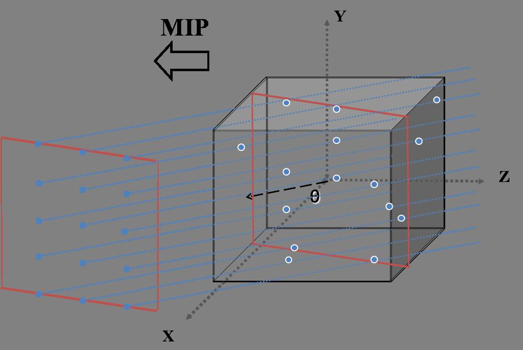 3.5. PRIOR KNOWLEDGE IN GUISE 51 Figure 3.6: Maximum Intensity Projection (MIP) of a 3D volume. The highest intensity value in the Projection direction is selected.