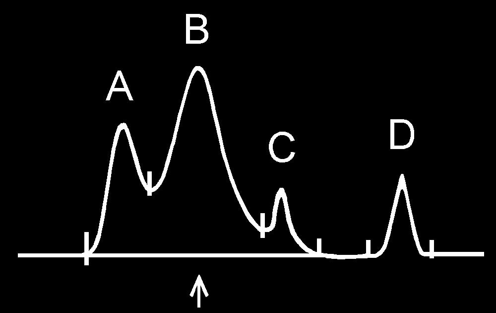 Peak Integration Flow Step 1: Peak Detection Parameter [Width] Function < >: Default Value [ ]: Setting Range The minimum width at half-height of peaks <3> (Unit: sec) [0.