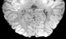 7. Fig. 9 shows the corresponding segmentation results of these three methods on the neonatal brain image given in Fig. 8.