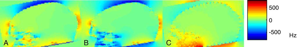 N. Xu et al. / Magnetic Resonance Imaging 25 (2007) 1376 1384 1379 Fig. 2. Interaction of field inhomogeneity and motion. (A) is the rotated field map. (B) is the field map of the rotated head.