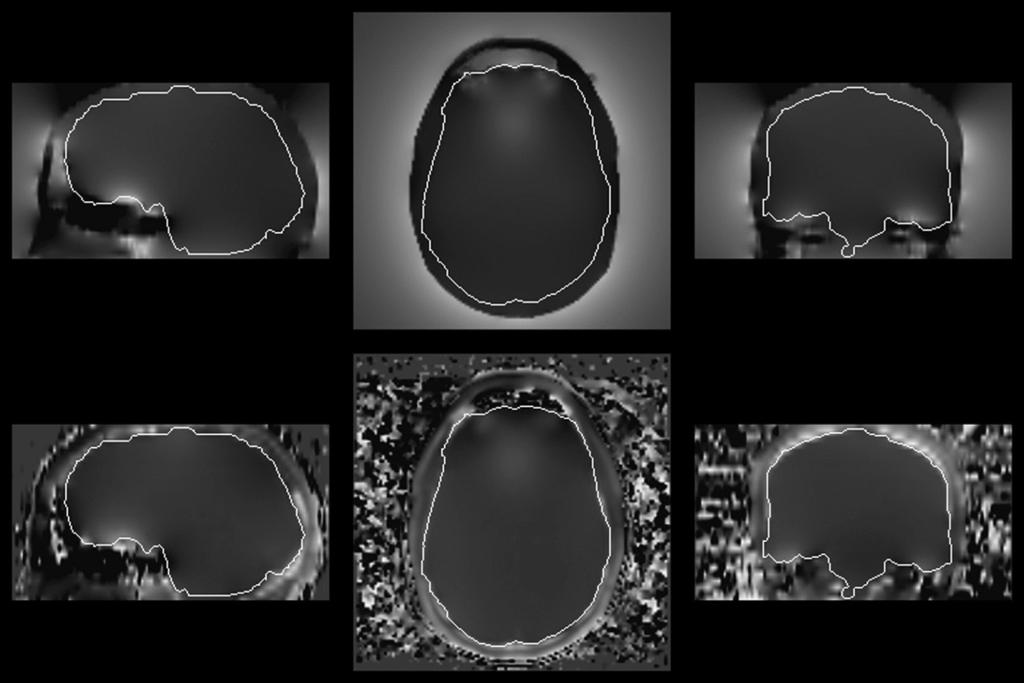 1380 N. Xu et al. / Magnetic Resonance Imaging 25 (2007) 1376 1384 Fig. 4. Comparison of calculated map to measured map. First row is calculated. Second row is measured.