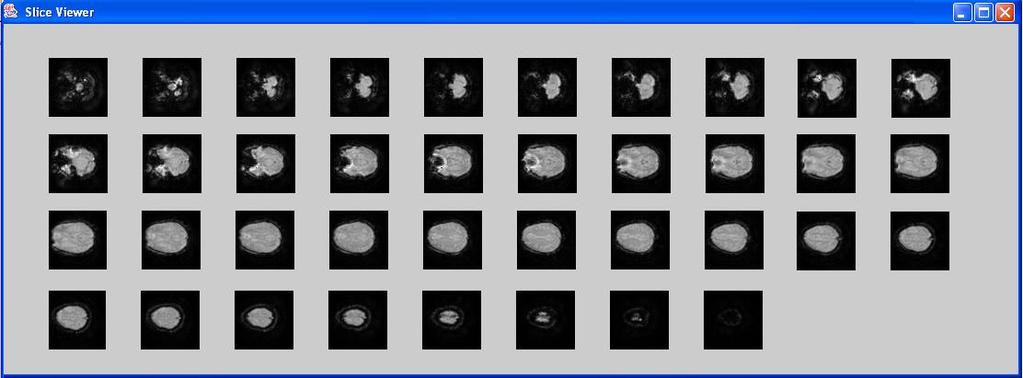 Fig 1. The 3D volumetric brain is represented as 38 slices of 2D images. Each Slice consists of 64 *64 voxels. This is the output of our Slice Viewer module. 3.2. Image Reconstruction and Registration The data is reconstructed using multi-frequency deblurring technique.