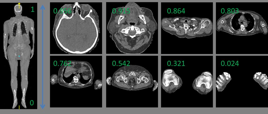 Fig. 2. Transversal slices of eight different body parts from one full body CT volume. The scores at upper left corners indicate their normalized body heights in the volume.