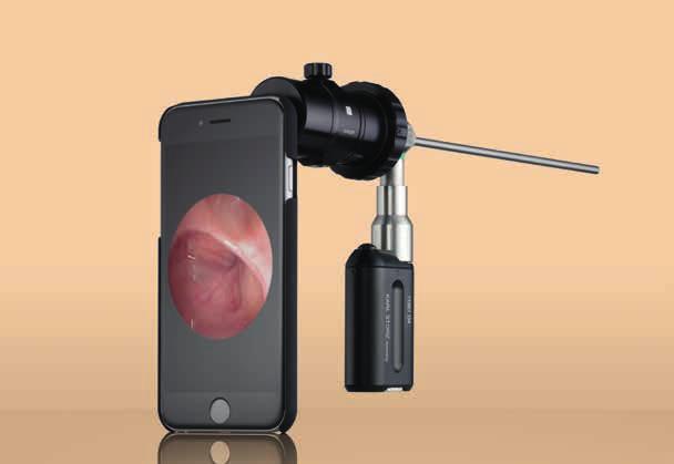SMART SCOPE The Endoscope Adaptor for Smartphones In combination with KARL STORZ endoscopes, the smartphone adaptor from KARL STORZ allows easy documentation of endoscopic images on a smartphone.