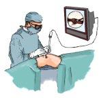 Figure 1-6: LEFT: Diagram of an arthroscopic knee surgery. The surgeon holds a scope with one hand and an instrument with the other. The view from the scope is projected on a monitor.