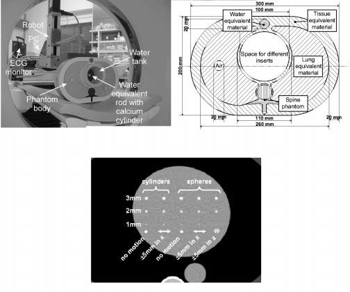 890 IEEE TRANSACTIONS ON MEDICAL IMAGING, VOL. 19, NO. 9, SEPTEMBER 2000 (a) (b) Fig. 1. Two phantoms are used to evaluate our algorithms.